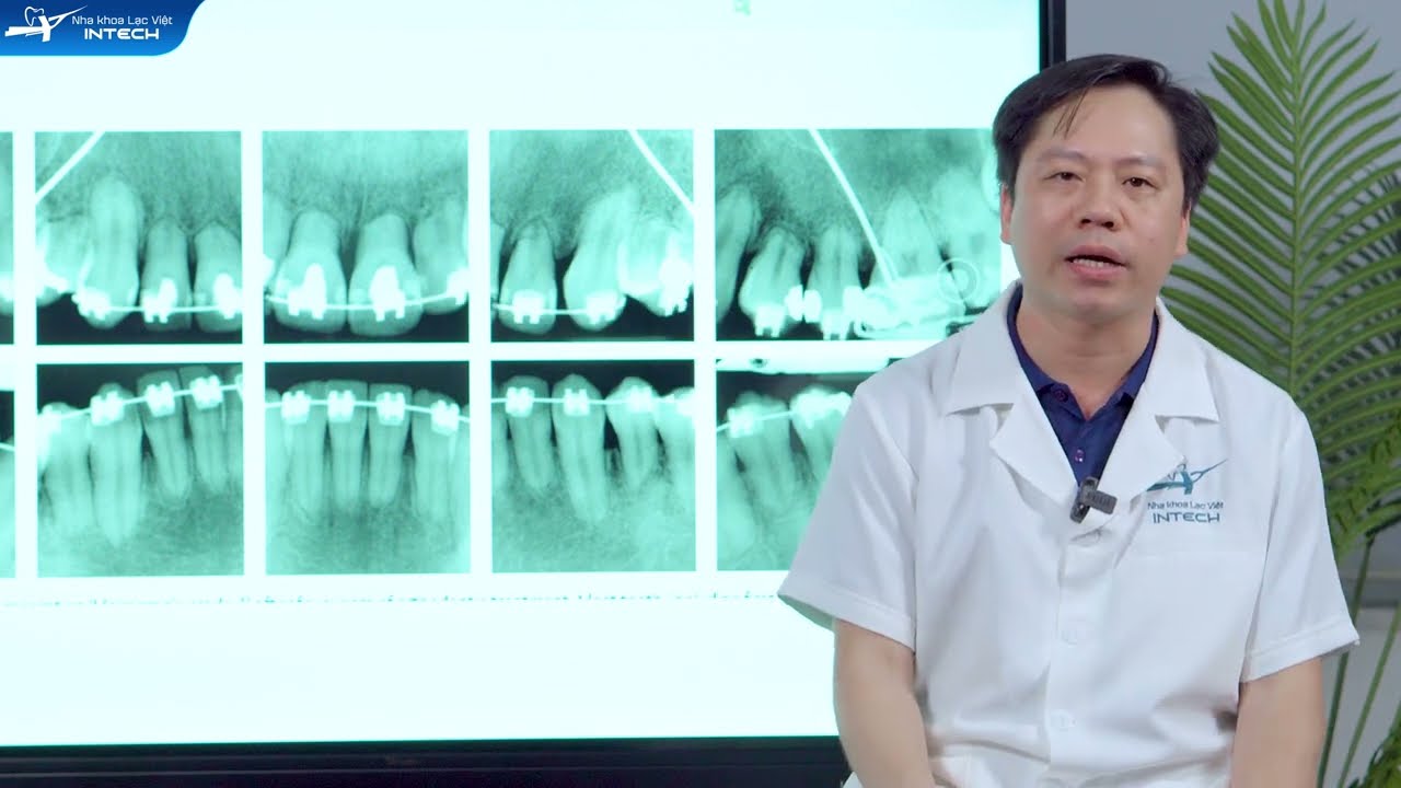 biến chứng niềng răng