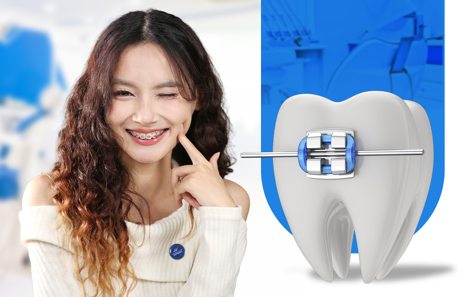 Niềng răng mắc cài mặt ngoài