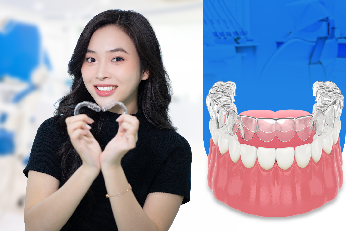 Niềng răng bằng khay trong suốt 