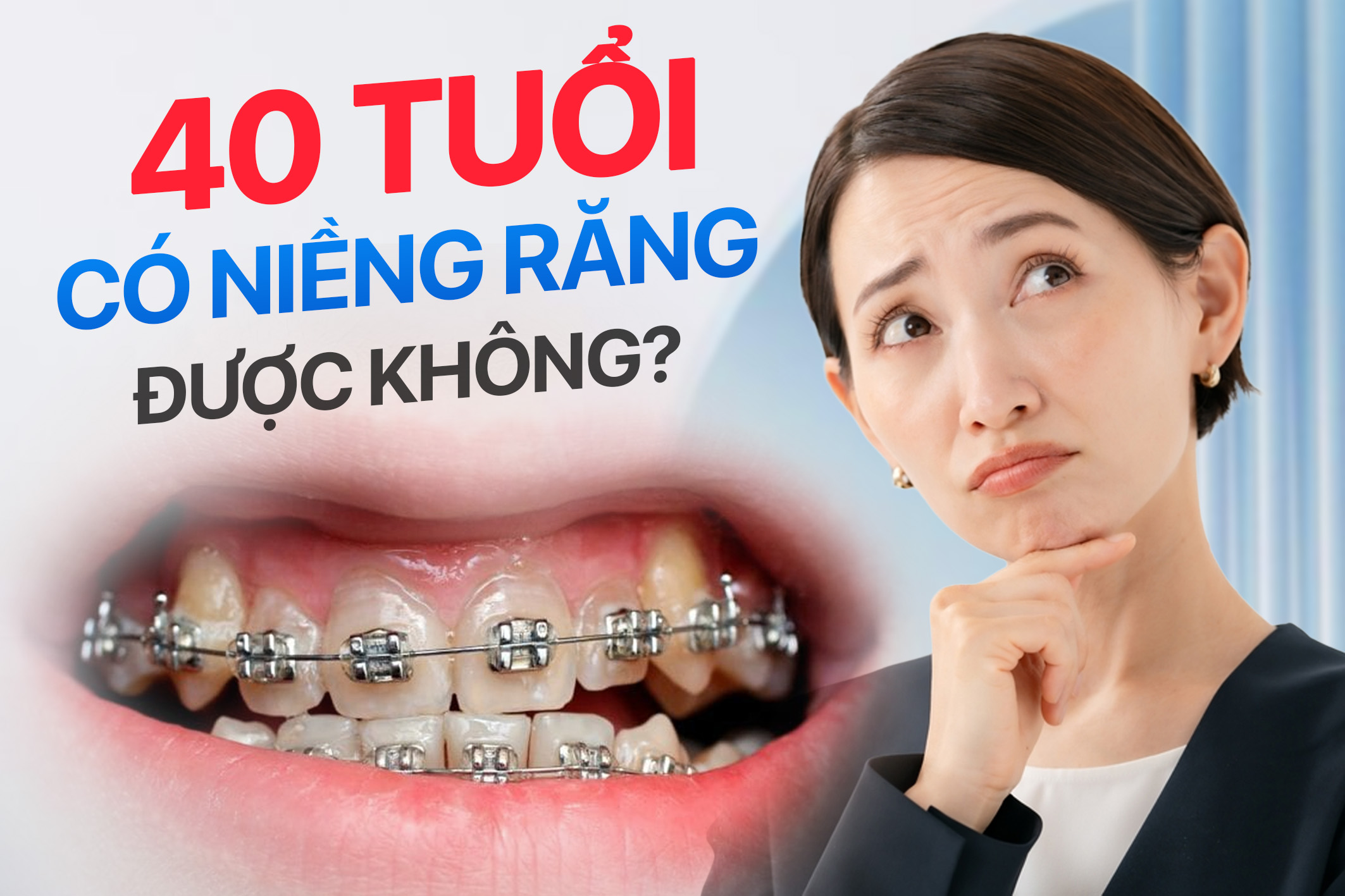 40 tuổi có niềng răng được không? Giải đáp chi tiết từ chuyên gia chỉnh nha hàng đầu! 