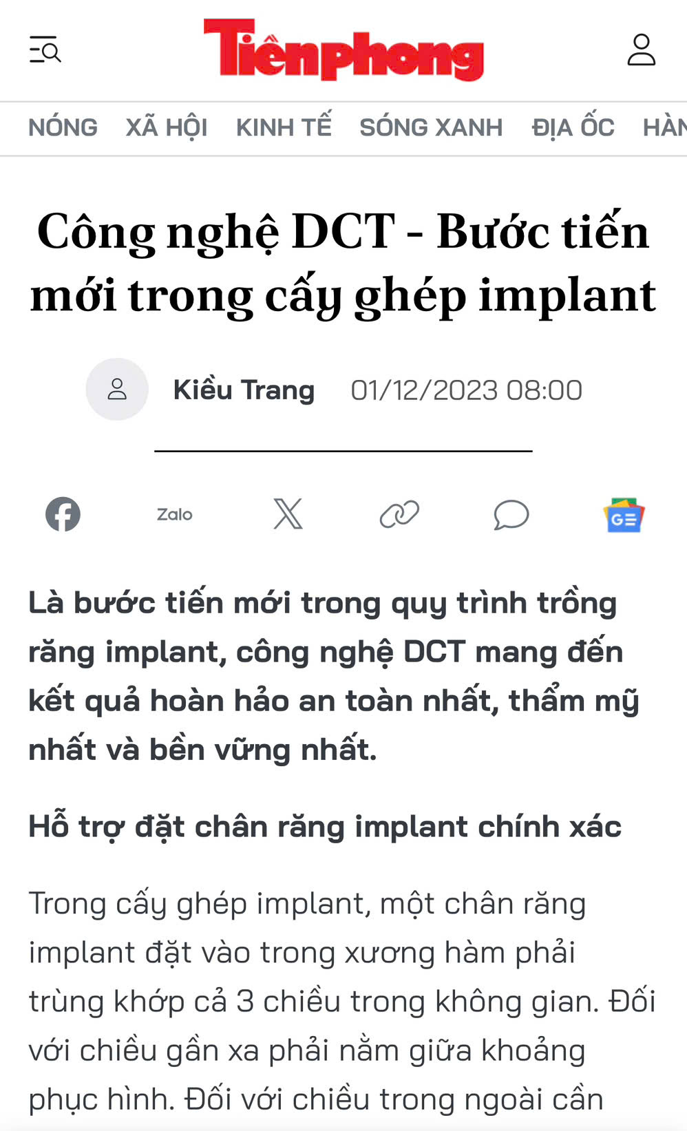 Công nghệ DCT - Bước tiến mới trong cấy ghép implant