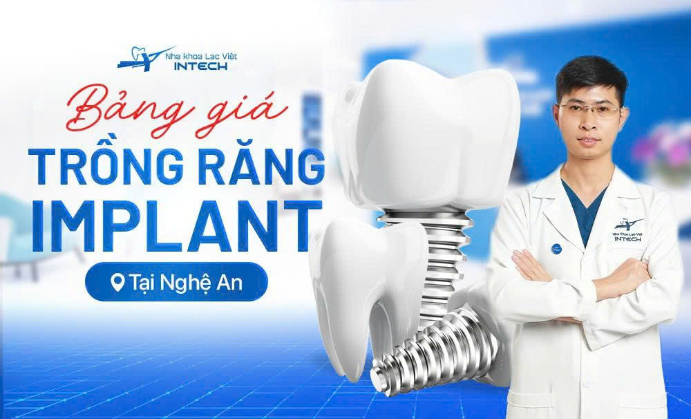 CHƯƠNG TRÌNH KHUYẾN MÃI ĐẶC BIỆT TẠI NGHỆ AN – GIẢM ĐẾN 40% CHI PHÍ TRỒNG RĂNG IMPLANT
