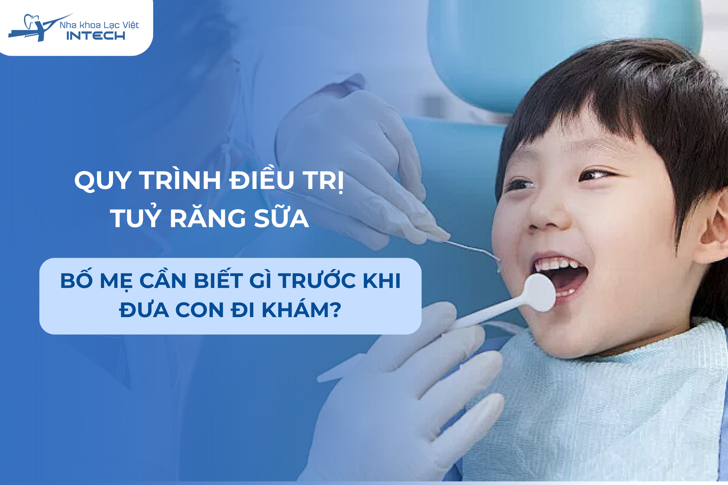 Quy trình điều trị tuỷ răng sữa: Bố mẹ cần biết gì trước khi đưa con đi khám?