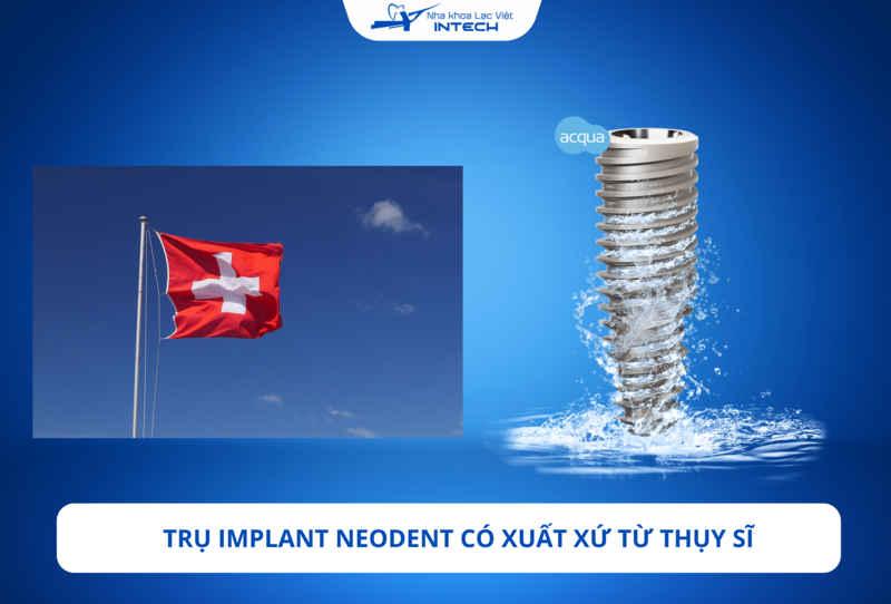 Trụ Neodent là lựa chọn tối ưu cho những ca khó 