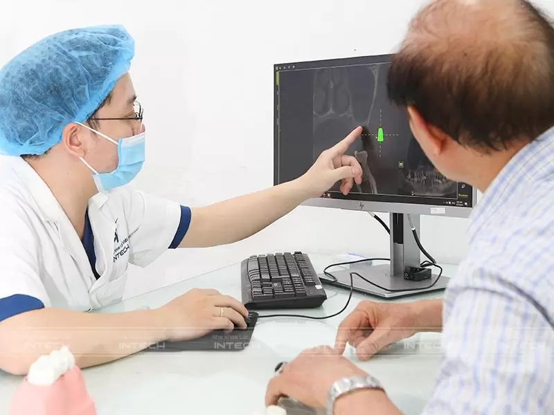 Bác sĩ phân tích phim chụp CT Cone Beam cho khách hàng mất răng 6 phục hồi bằng trồng răng implant