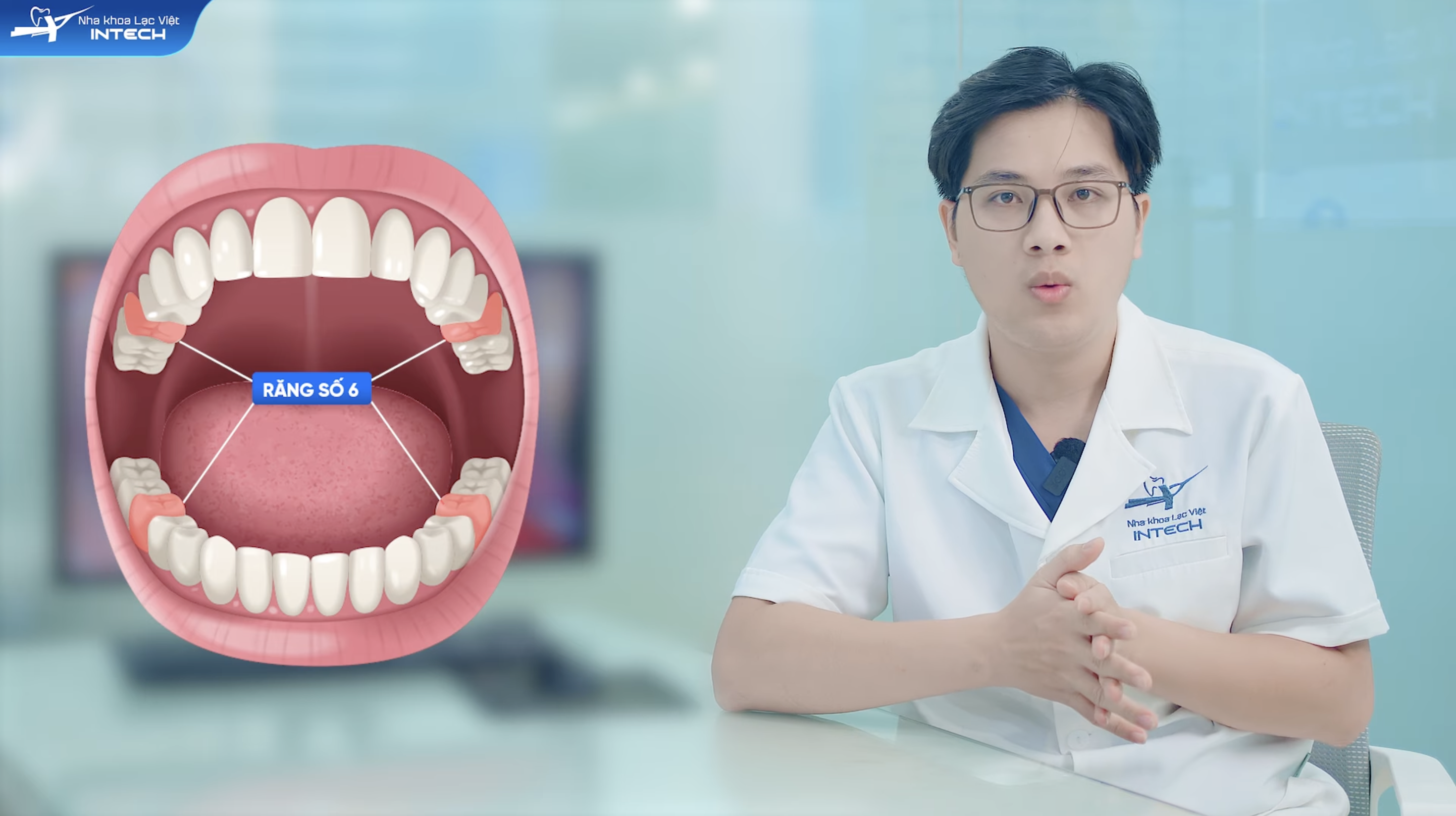 Răng số 6 (hay còn gọi là răng hàm lớn thứ nhất) là một trong những chiếc răng quan trọng nhất trong cung hàm vĩnh viễn.