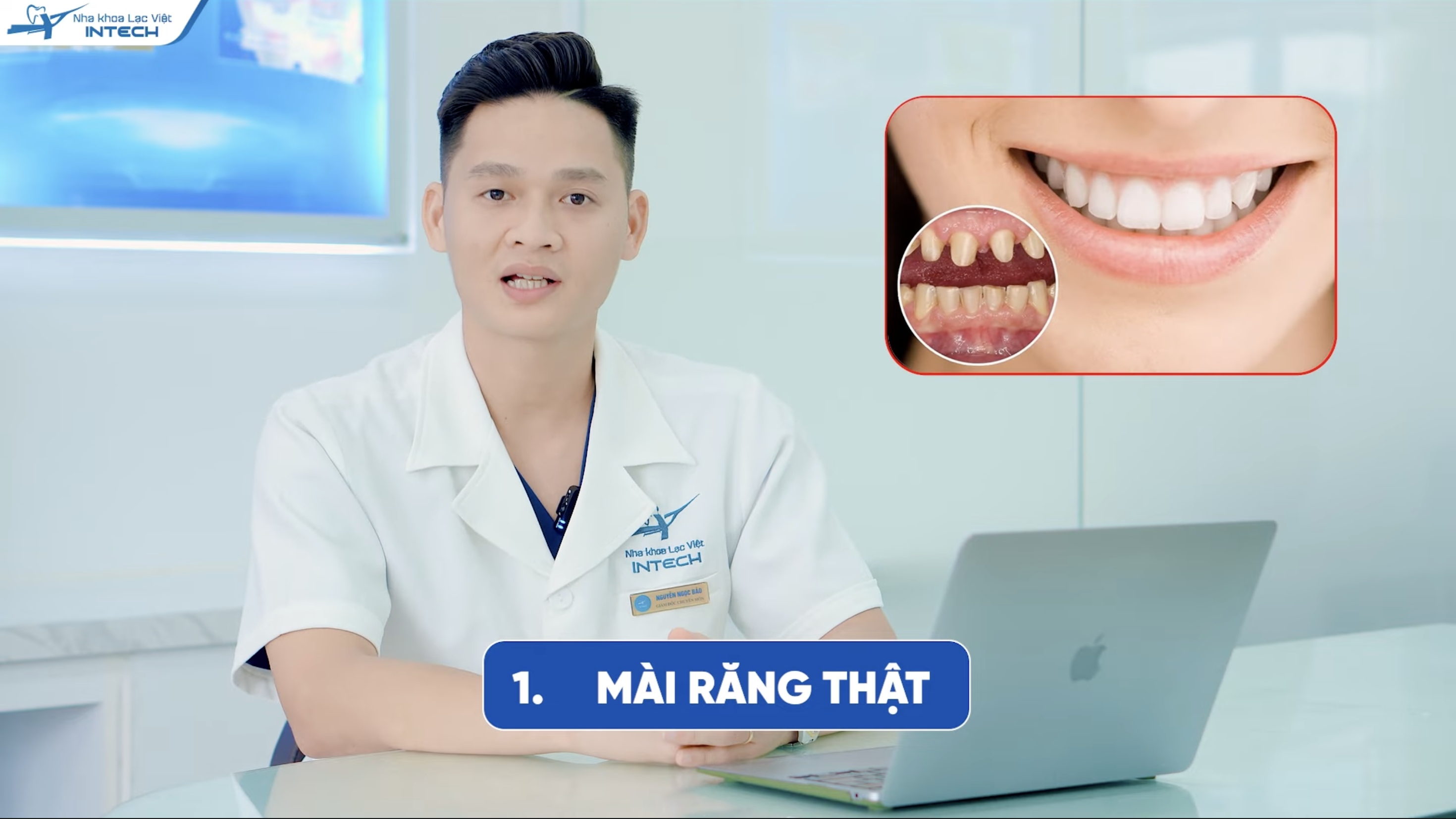 Bọc răng sứ phải mài nhỏ răng thật, nếu làm sai kĩ thuật thì có thể dẫn tới nhiều hậu quả nghiêm trọng