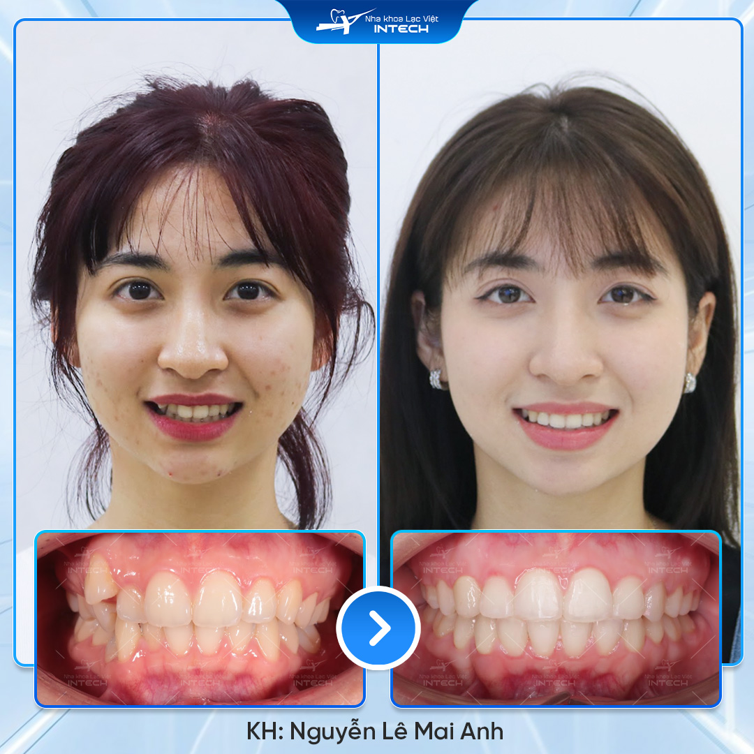 Nguyễn Lê Mai Anh