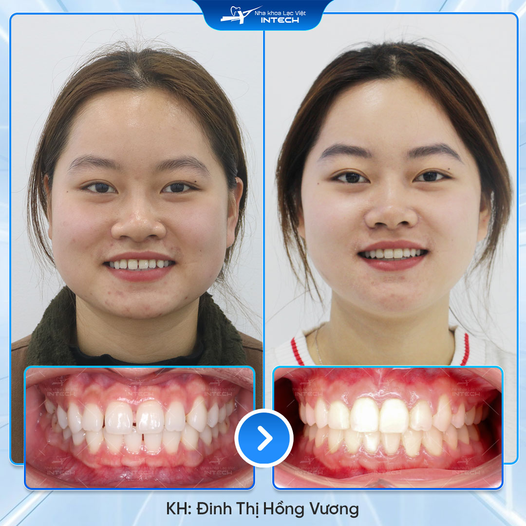 Đinh Thị Hồng Vương 