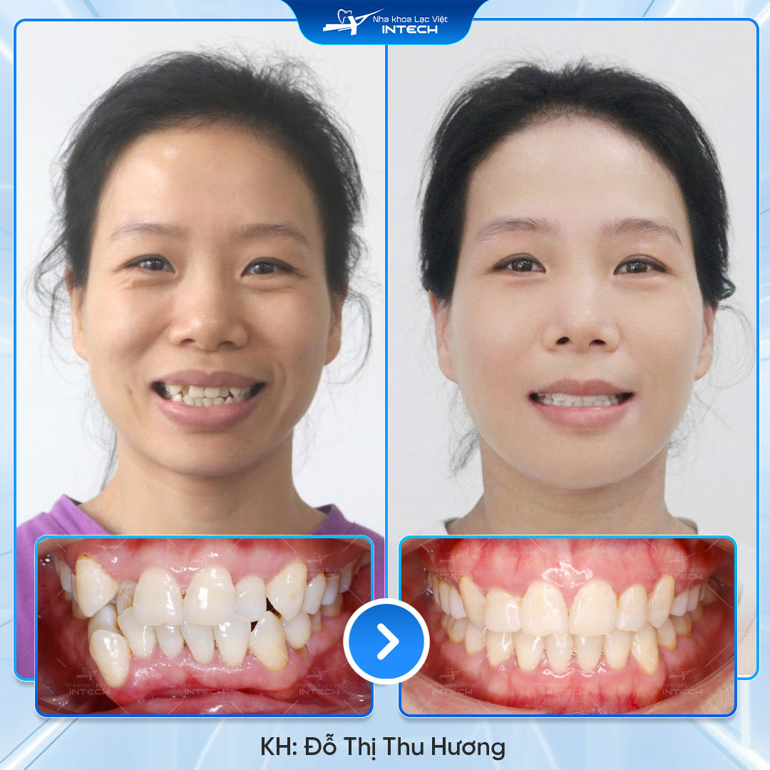 Đỗ Thị Thu Hương 