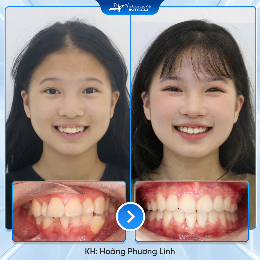 Hoàng Phương Linh 