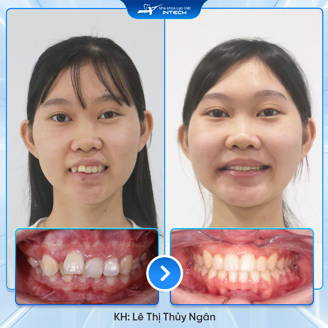 Lê Thị Thủy Ngân 