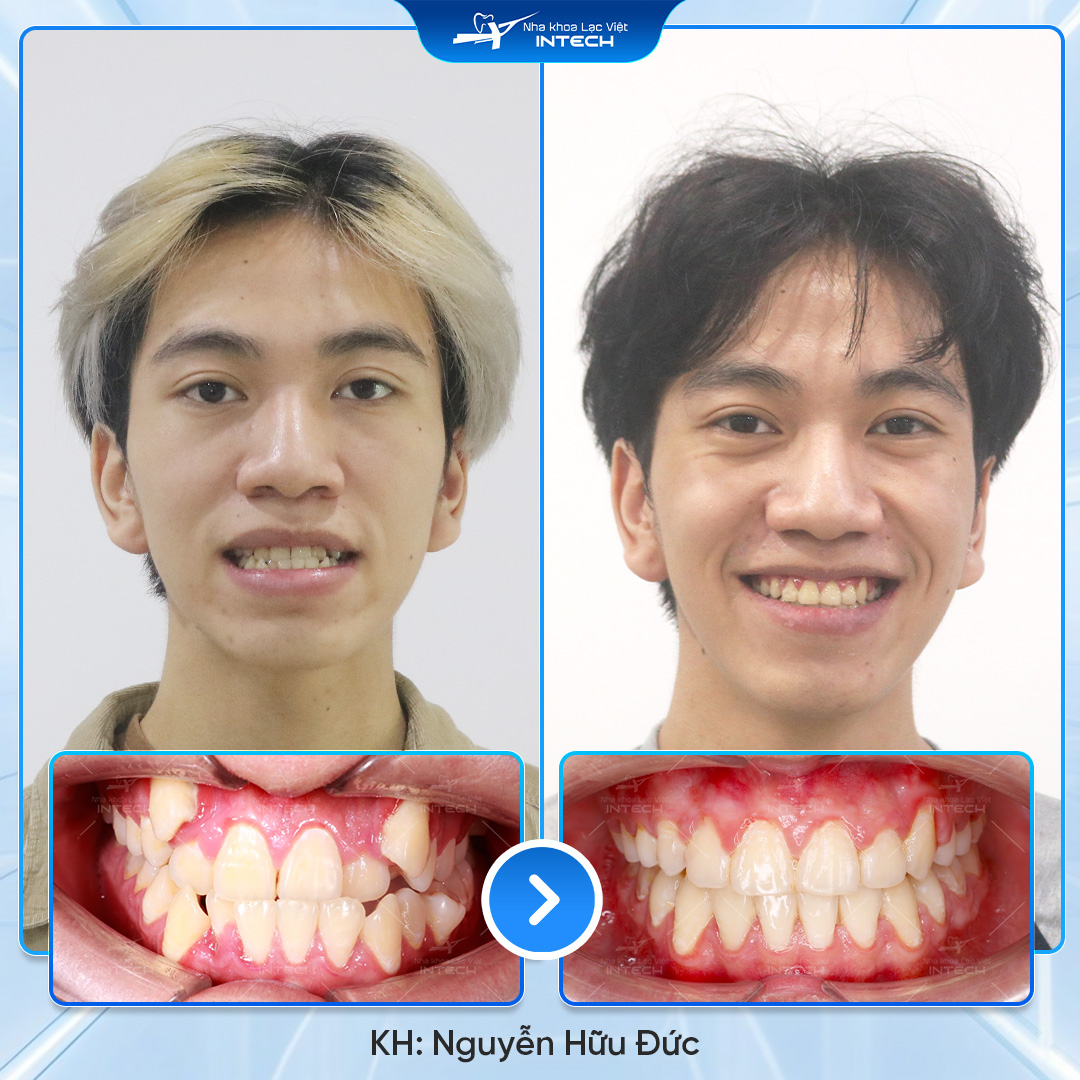 Nguyễn Hữu Đức 