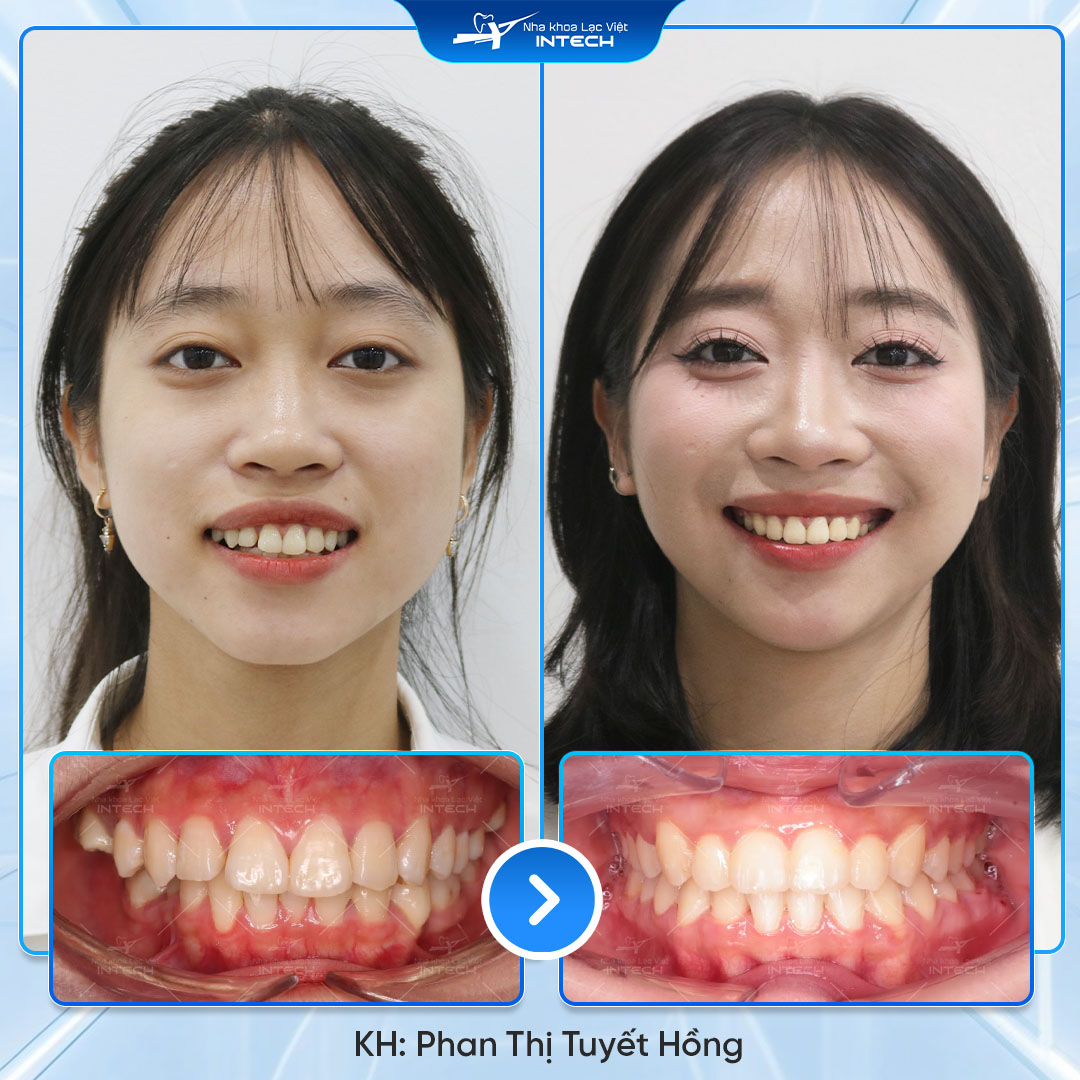 Phạm Thị Tuyết Hồng 