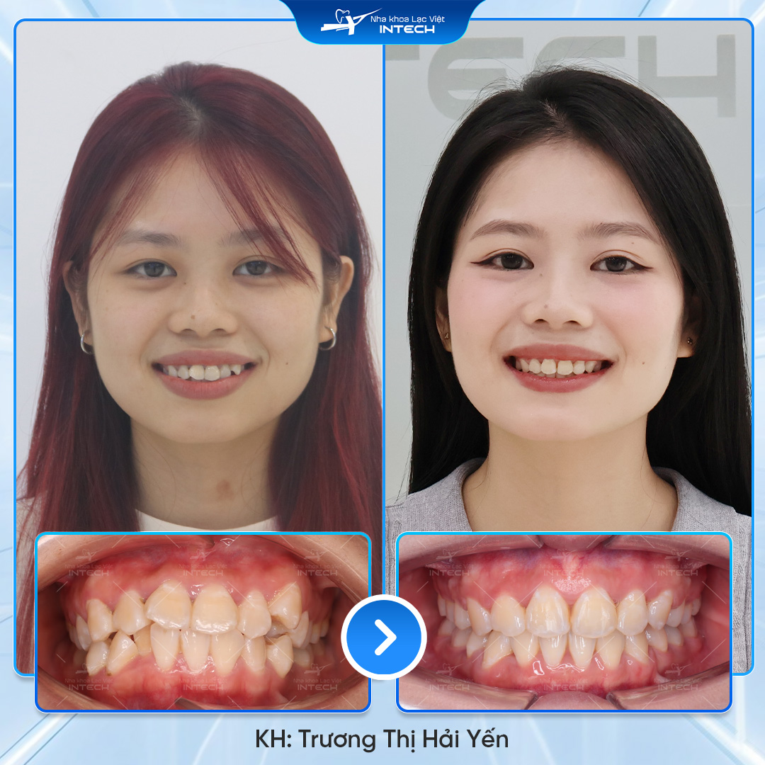 Trương Thị Hải Yến 