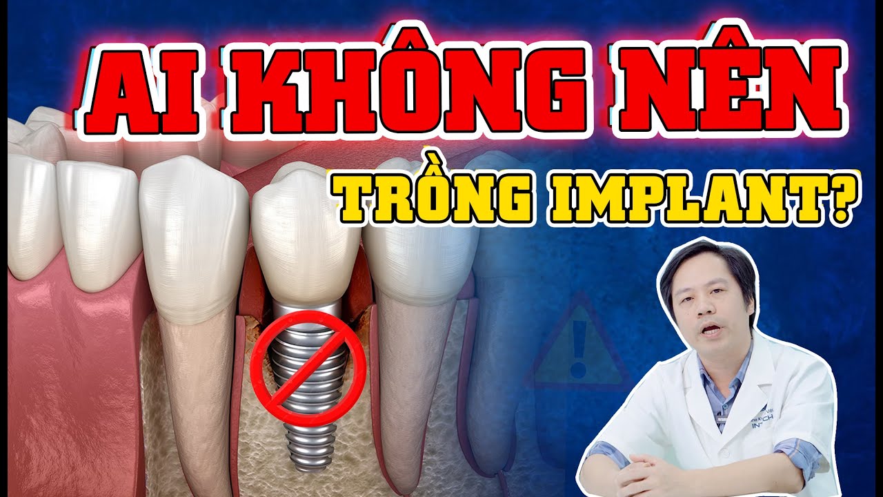 Những ai không nên cấy ghép Implant, 4 trường hợp tuyệt đối cấm kỵ