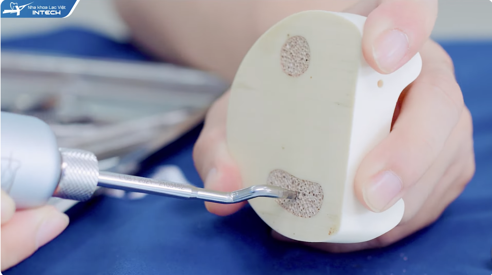 công nghệ phẫu thuật siêu âm cao tần