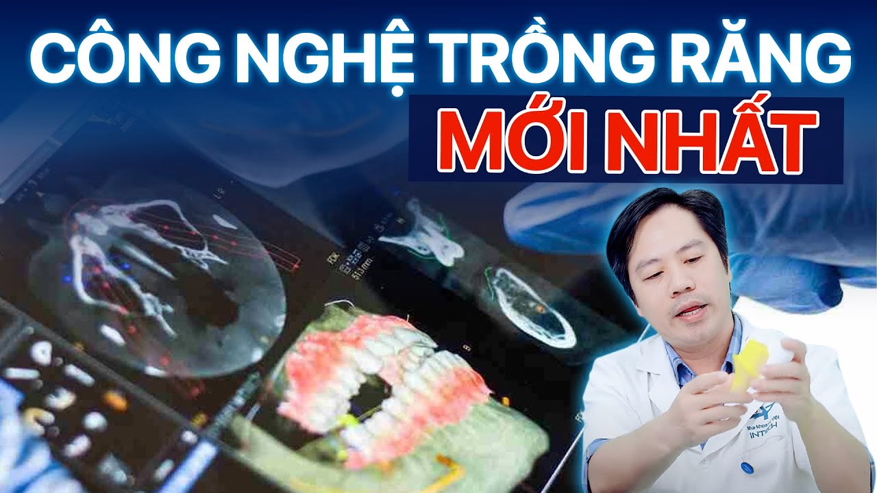 Công Nghệ Trồng Răng Mới Nhất 2025: Top 6 Công Nghệ Dẫn Đầu Xu Hướng
