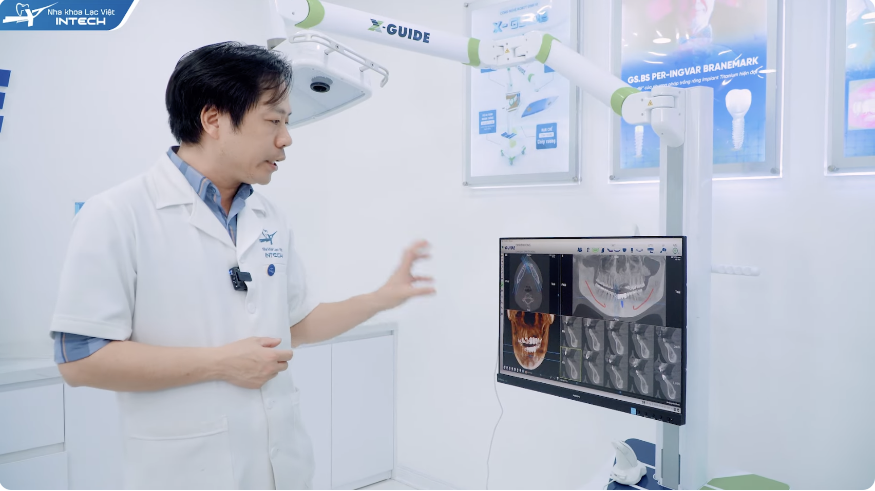 robot định vị X-guide