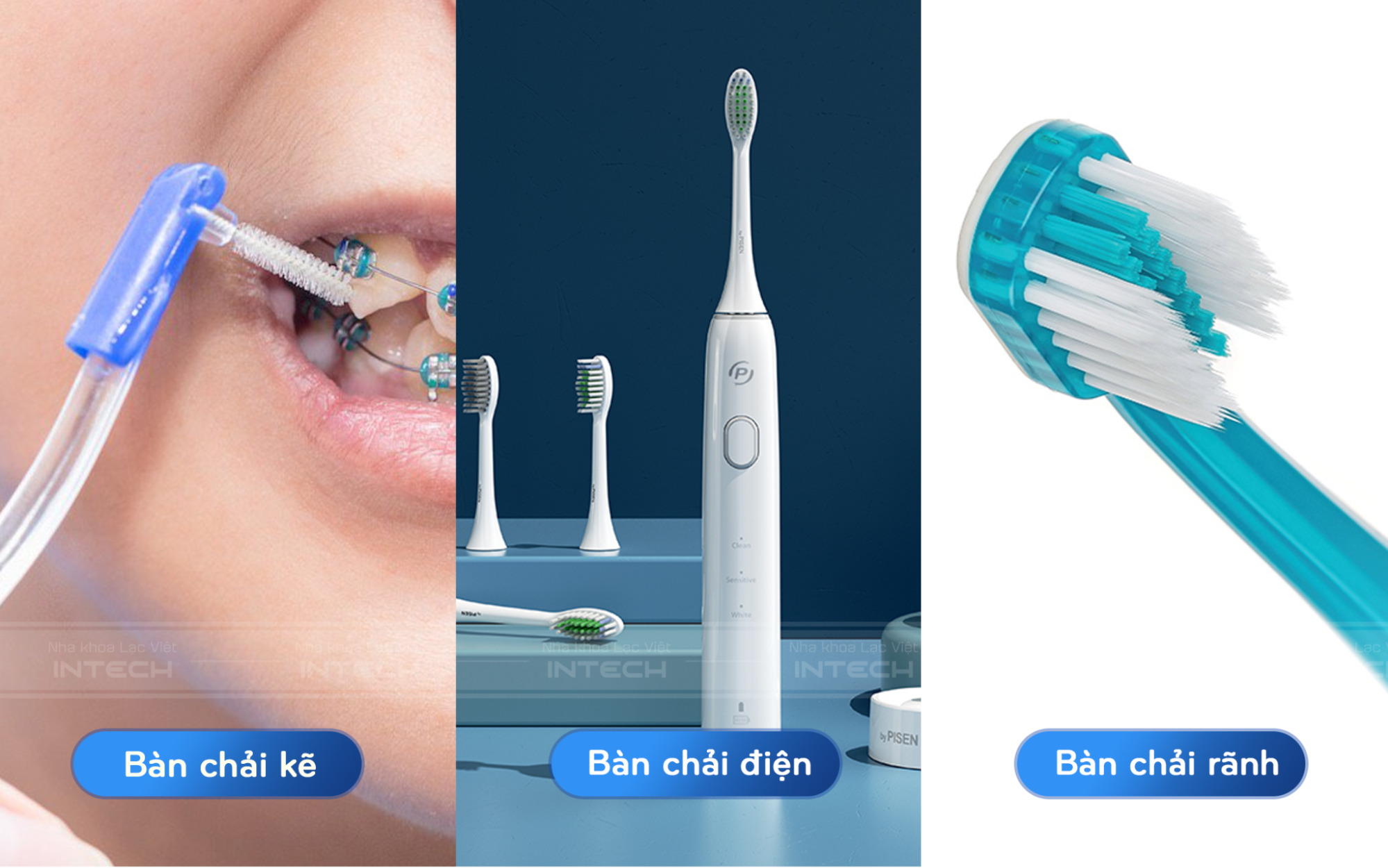 Để vệ sinh răng miệng khi niềng răng, bạn nên sử dụng các loại bàn chải chuyên dụng