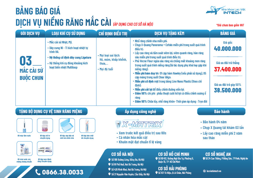 bảng giá niềng răng mắc cài sứ tại Hà Nội