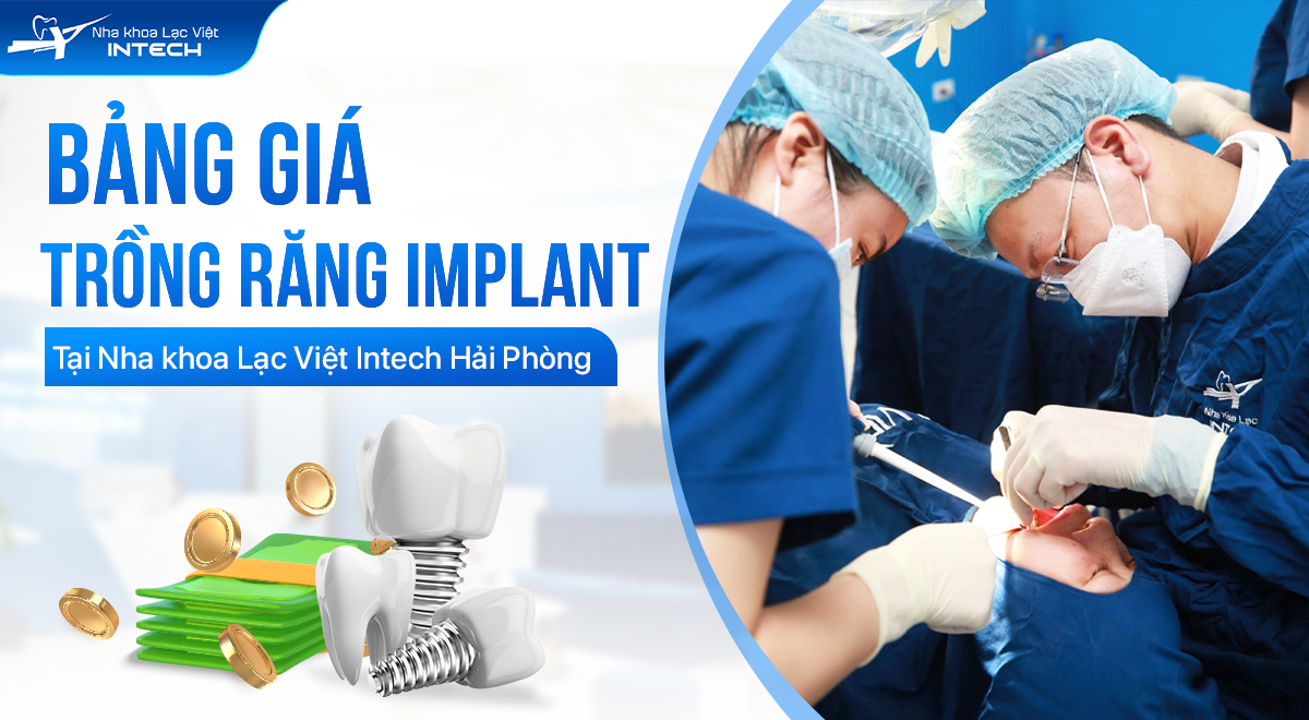 Bảng giá trồng răng implant tại Nha khoa Lạc Việt Intech Hải Phòng