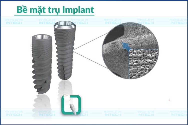 Bề mặt trụ Implant Neo Active