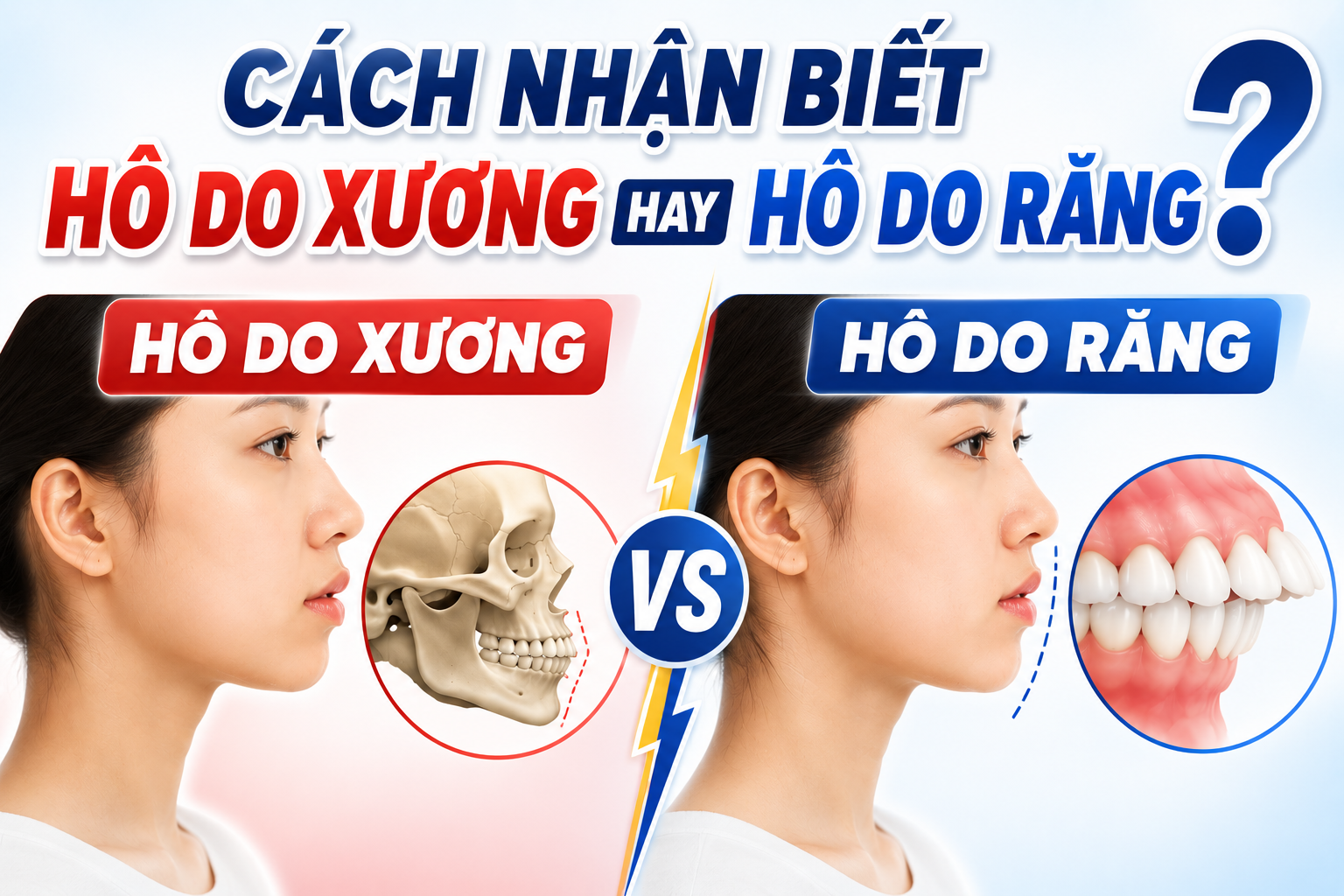 Cách nhận biết hô do răng hay do xương: Phân tích chuyên sâu từ góc nhìn chỉnh nha