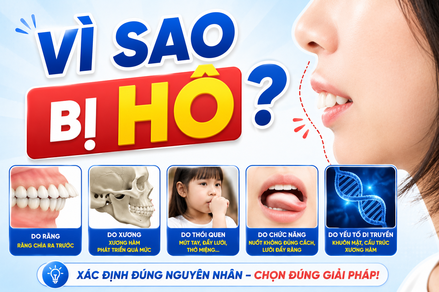Vì sao bạn bị hô? 5 nguyên nhân phổ biến và cách bác sĩ xác định chính xác
