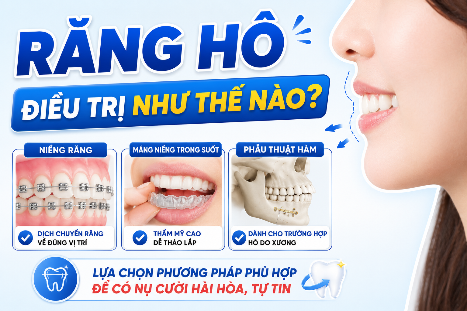 Hô điều trị như thế nào? Khi nào có thể kéo lùi răng bằng chỉnh nha, khi nào phải can thiệp xương hàm