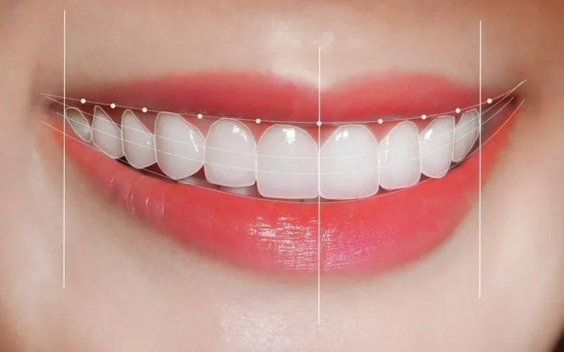 tiêu chuẩn tướng răng đẹp