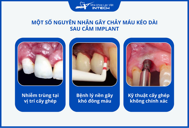 Nguyên nhân dẫn đến các biến chứng sau cấy ghép có thể là do sai sót trong phẫu thuật, nhiễm trùng hoặc do bệnh lý toàn thân của cô chú/anh chị