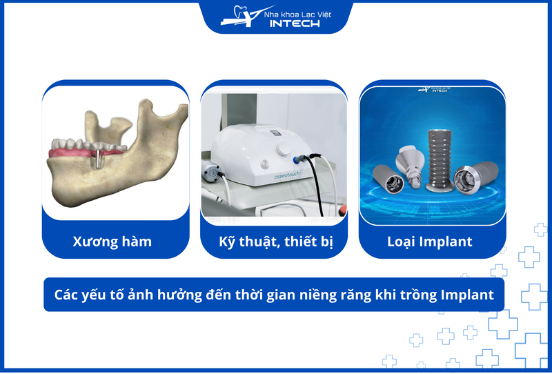 Thời gian hợp lý để niềng răng sau ghép Implant còn tùy thuộc vào những yếu tố trên