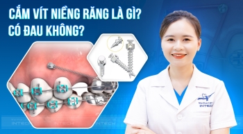 CẮM VIS NIỀNG RĂNG CÓ ĐAU KHÔNG? RỦI RO KHI CẮM VIS 
