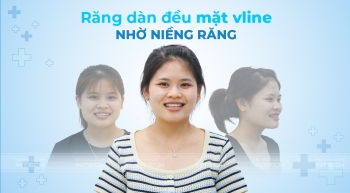 RĂNG DÀN ĐỀU, MẶT VLINE NHỜ NIỀNG RĂNG