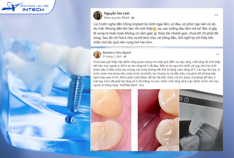 Bác sĩ sẽ gây tê khi cấy ghép nên cô chú/anh chị sẽ không thấy đau, tuy nhiên có thể đau nhẹ sau cấy ghép do phản ứng tự nhiên của cơ thể