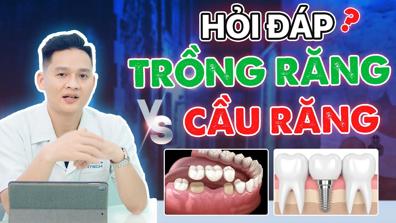 Mất Răng: Làm Cầu Răng Sứ Hay Trồng Răng Implant? Chuyên Gia Giải Đáp Những Câu Hỏi Thường Gặp