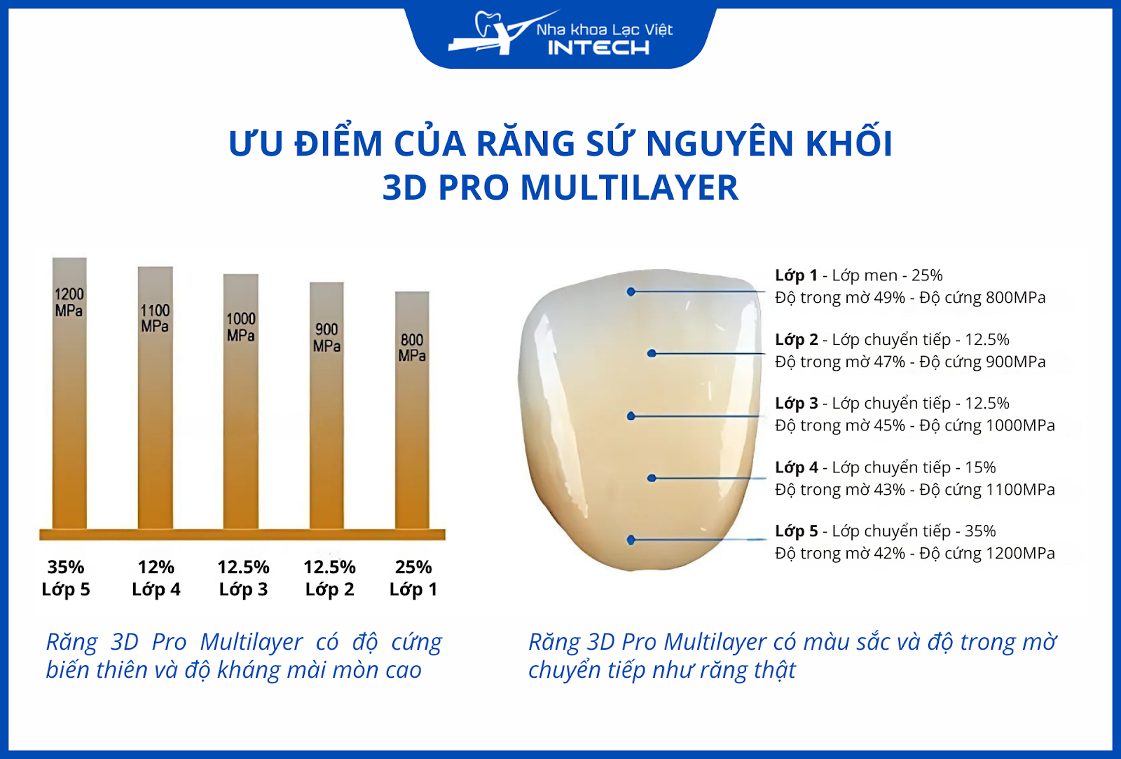 Mão răng sứ 3D Pro Multilayer có độ cứng biến thiên, mang đến cảm giác ăn nhai tự nhiên và hạn chế sang chấn răng đối