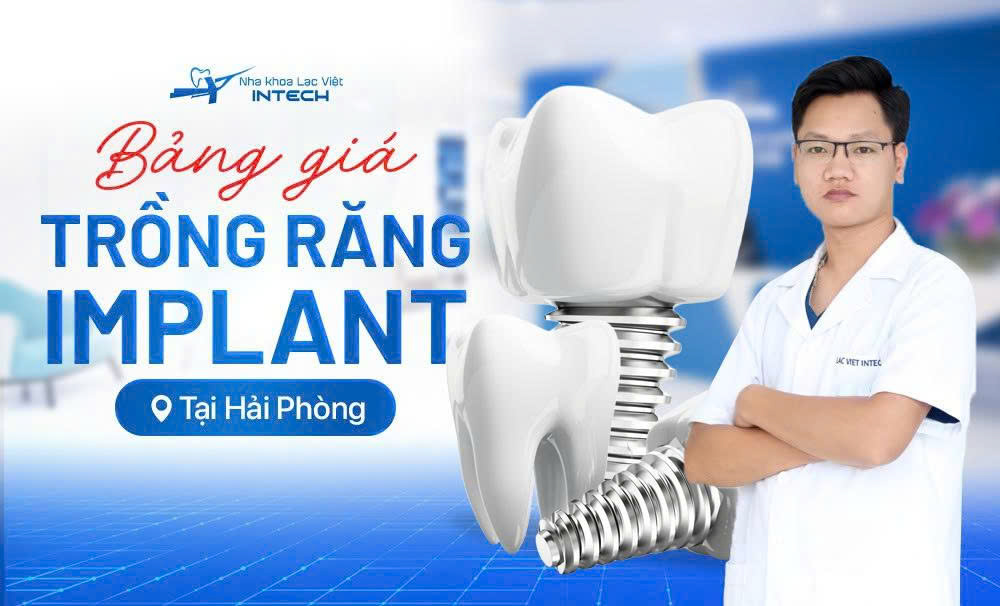 CHƯƠNG TRÌNH KHUYẾN MÃI ĐẶC BIỆT TẠI HẢI PHÒNG – GIẢM ĐẾN 40% CHI PHÍ TRỒNG RĂNG IMPLANT