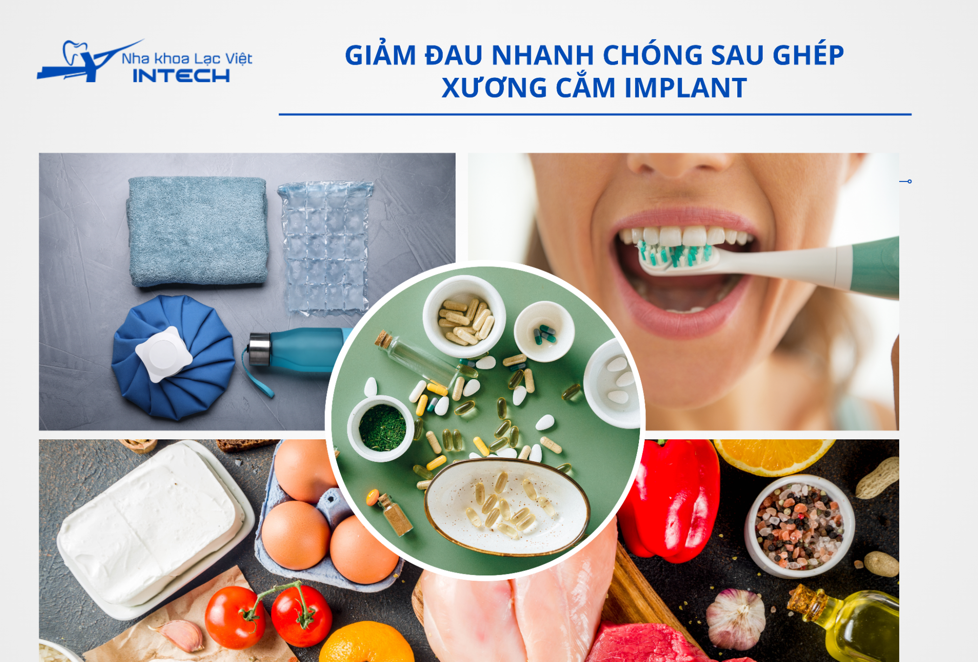 Có thể thực hiện chườm nóng/lạnh, chăm sóc răng miệng đúng cách, duy trì chế độ ăn lành mạnh nhằm giảm cảm giác khó chịu sau khi cấy ghép xương 