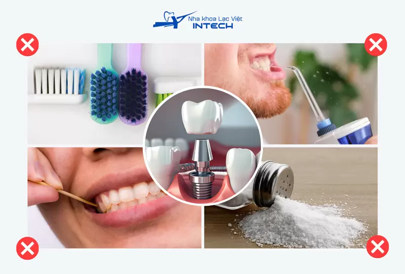 Cô chú/anh chị không nên sử dụng bàn chải quá cứng, nước muối có tính sát khuẩn cao hay tác động lực mạnh nên vị trí vừa cấy Implant