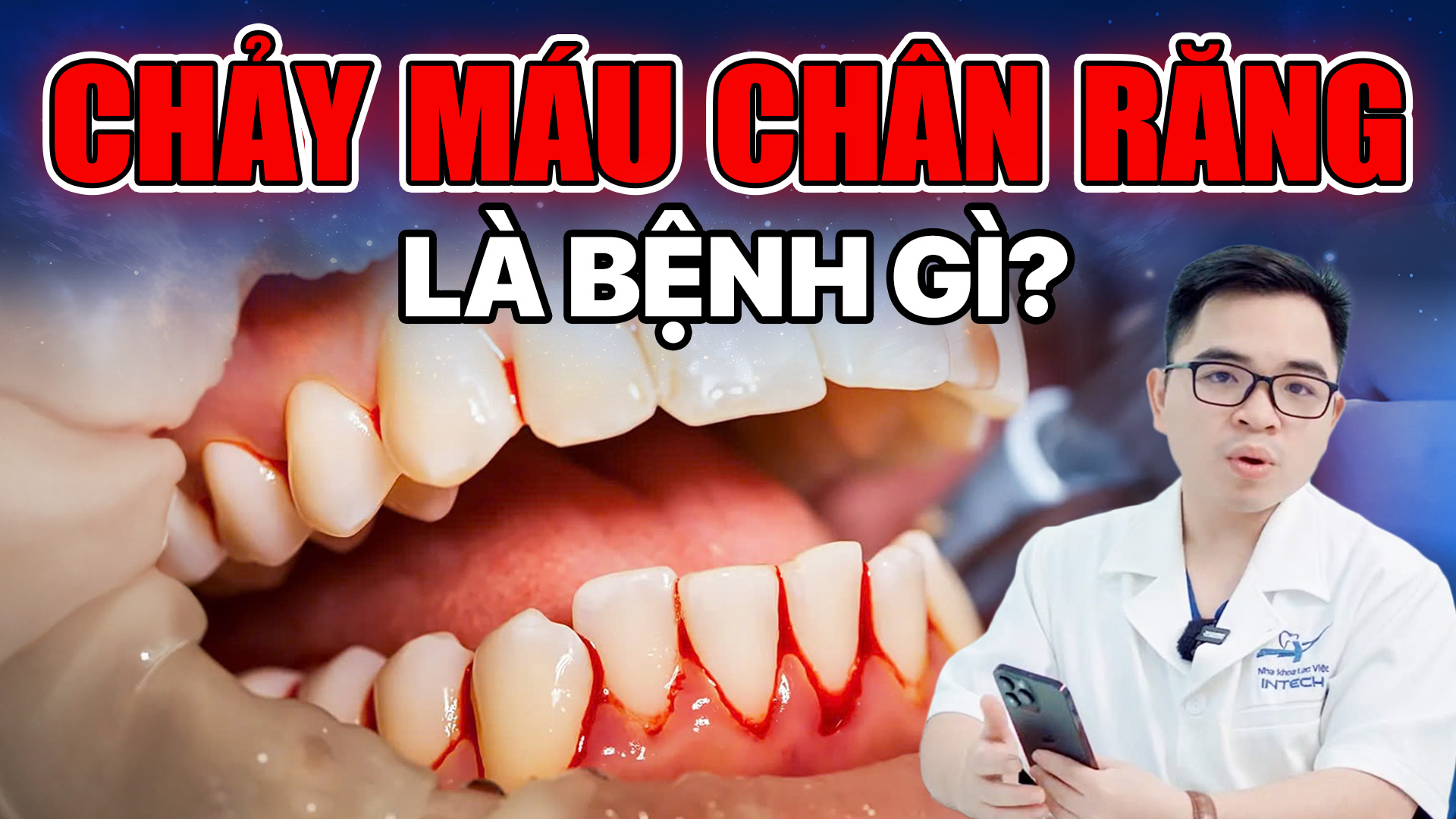 Chảy máu chân răng: Nguyên nhân, cách điều trị và phòng ngừa hiệu quả