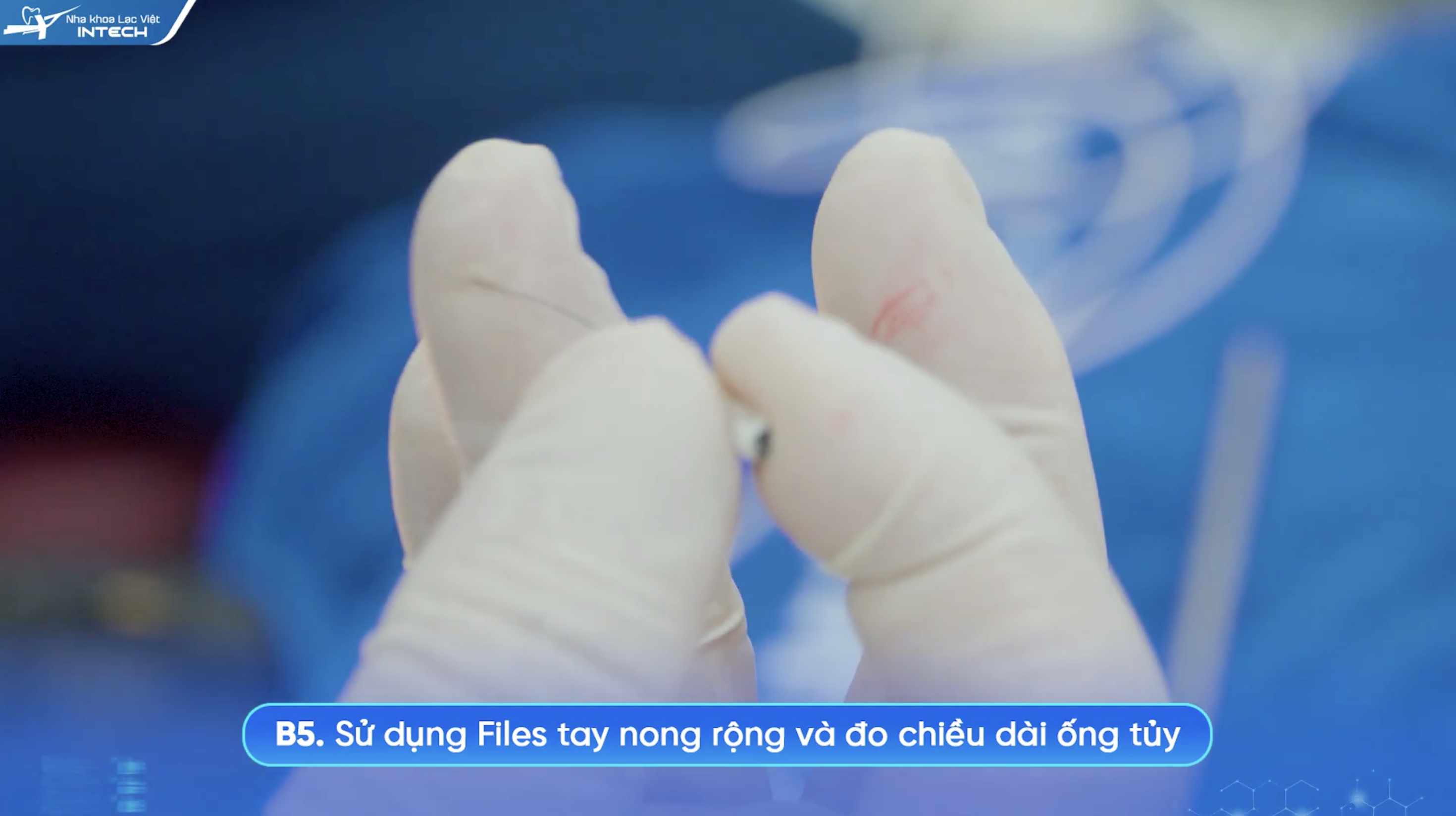 Đo chiều dài ống tuỷ
