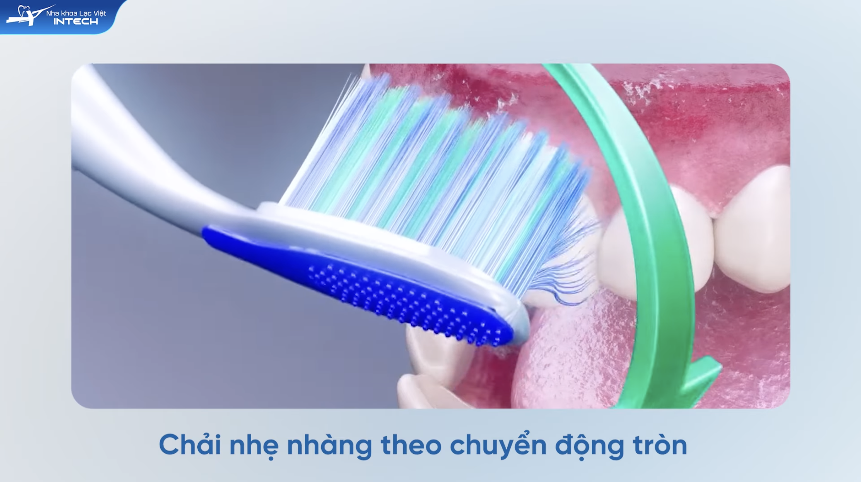 Chăm sóc răng miệng đúng cách tại nhà là cách điều trị hiệu quả