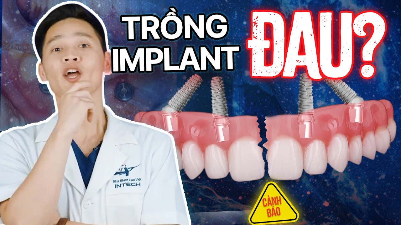 Trồng răng Implant có đau không? 3 sự thật về cơn đau khi trồng răng