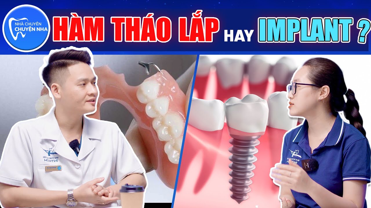 So sánh hàm giả tháo lắp và trồng răng Implant: Lựa chọn nào tốt hơn?