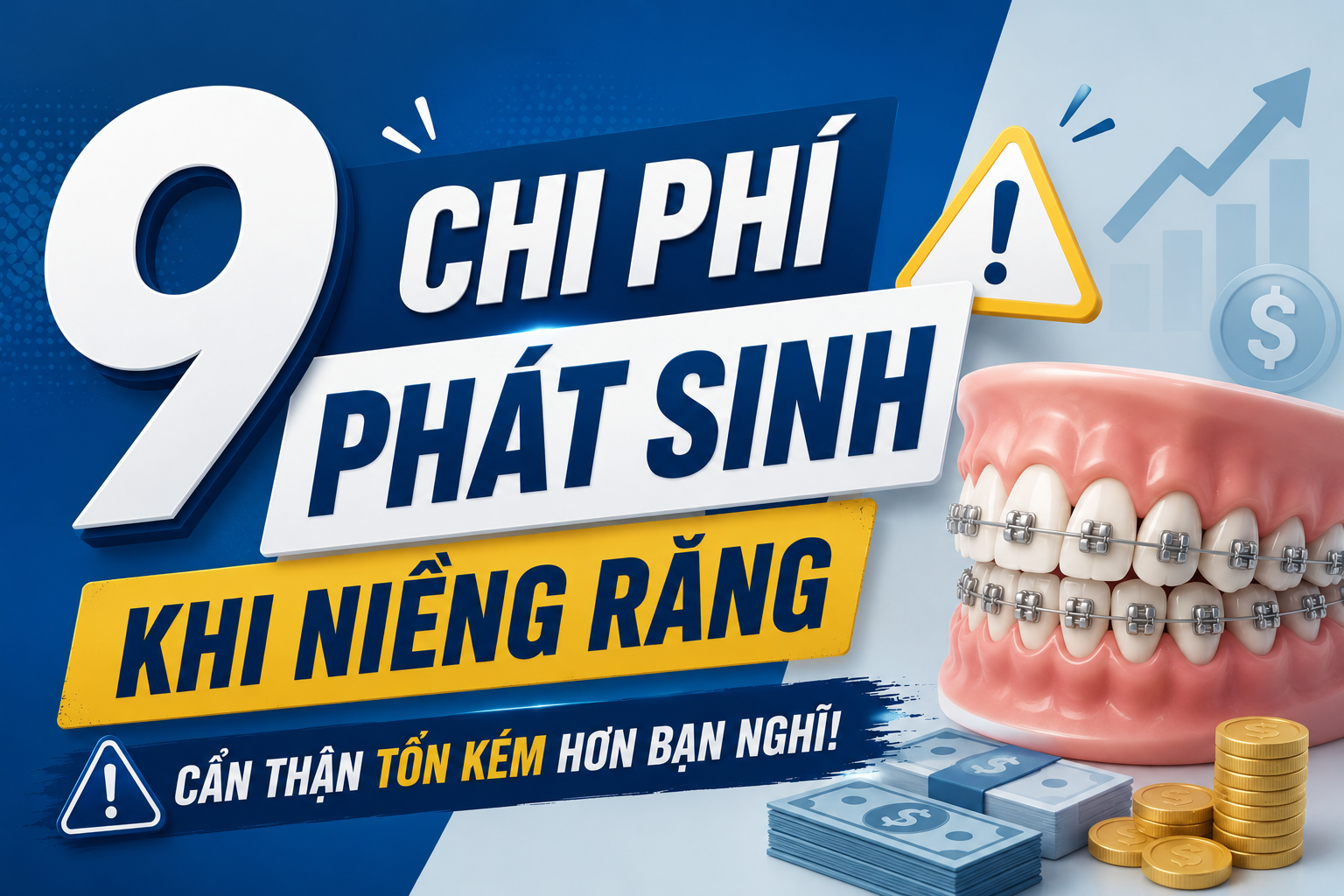 9 loại chi phí phát sinh khi niềng răng có thể khiến bạn mất hàng chục triệu đồng