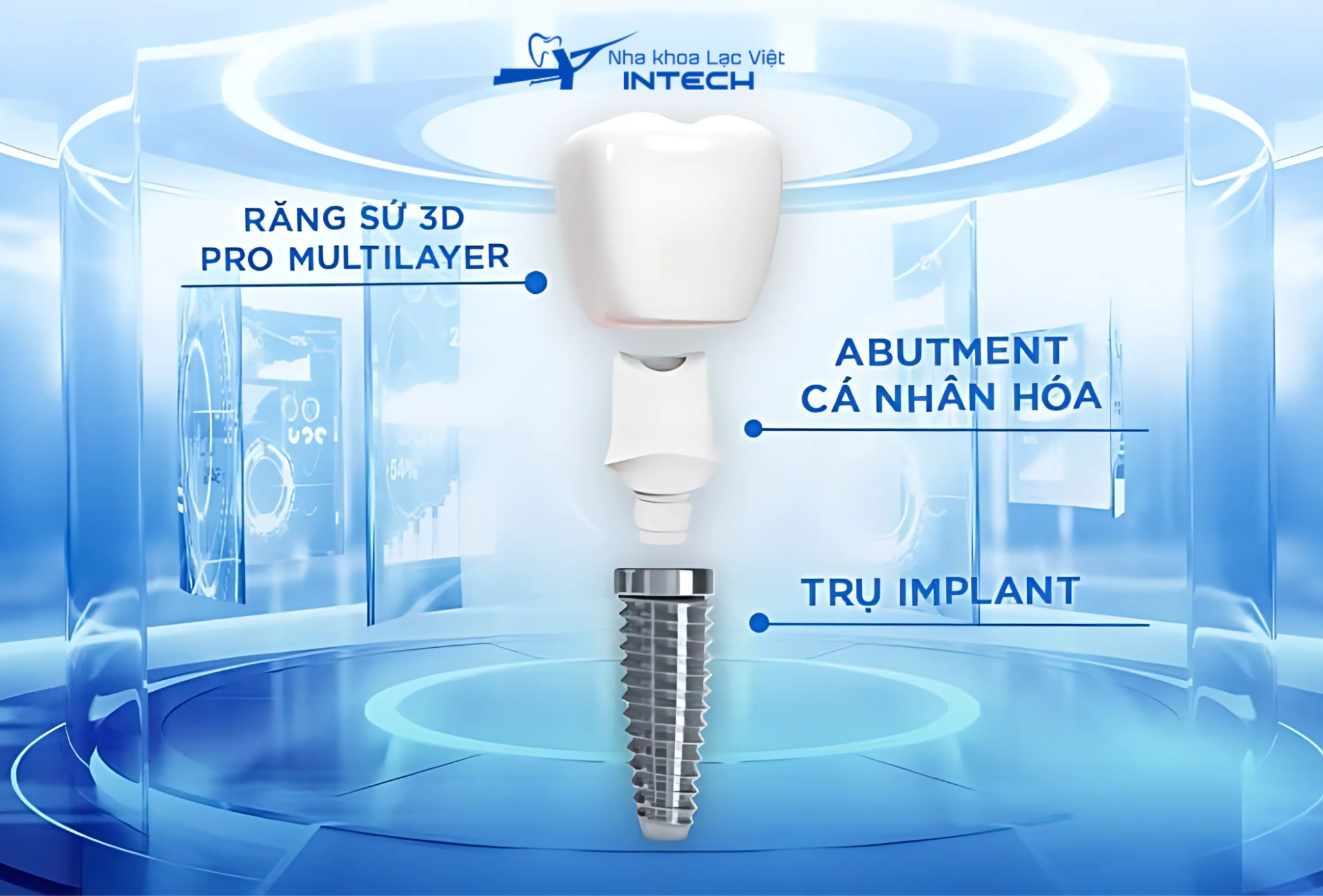 Chi phí trồng răng Implant không đau tương tự với chi phí của các phương pháp trồng răng truyền thống