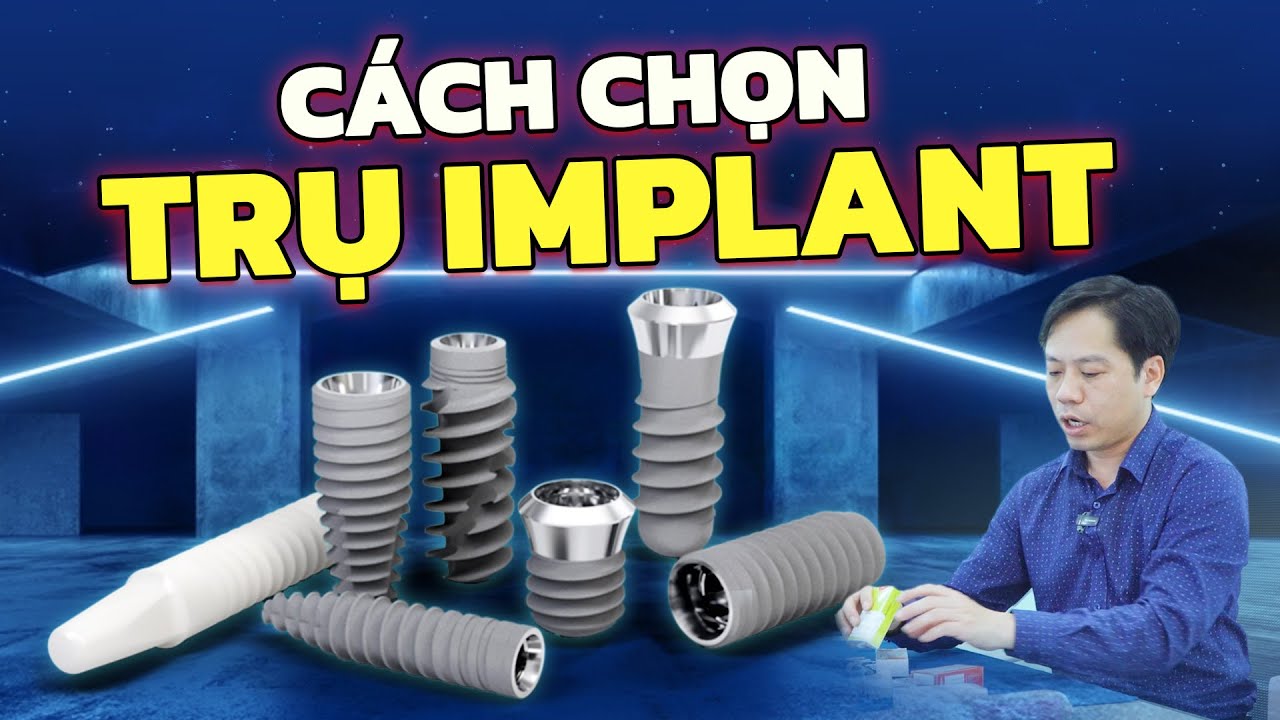 Nên Chọn Trụ Implant Nào? Top 5+ Trụ Implant Được Lạc Việt Intech "Tuyển Chọn" 