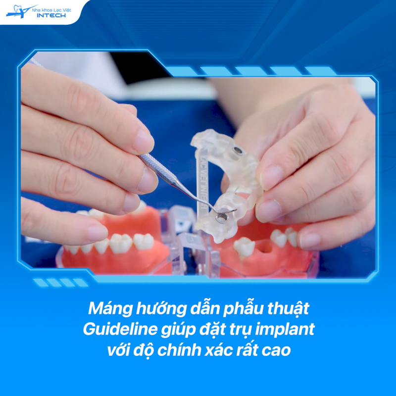Các thiết bị hỗ trợ cấy ghép giúp bác sĩ cấy ghép chính xác hơn dựa trên các dữ liệu đã phân tích, từ đó tăng khả năng thành công